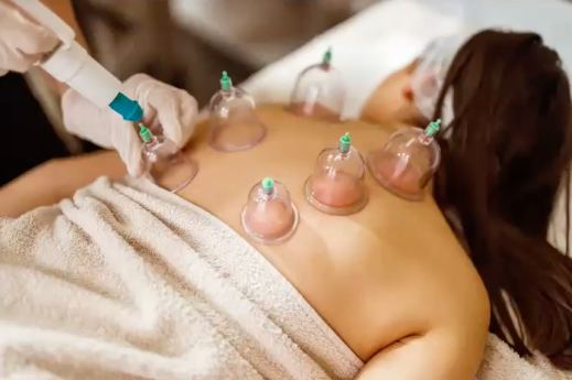 Woman taking Cupping therapy